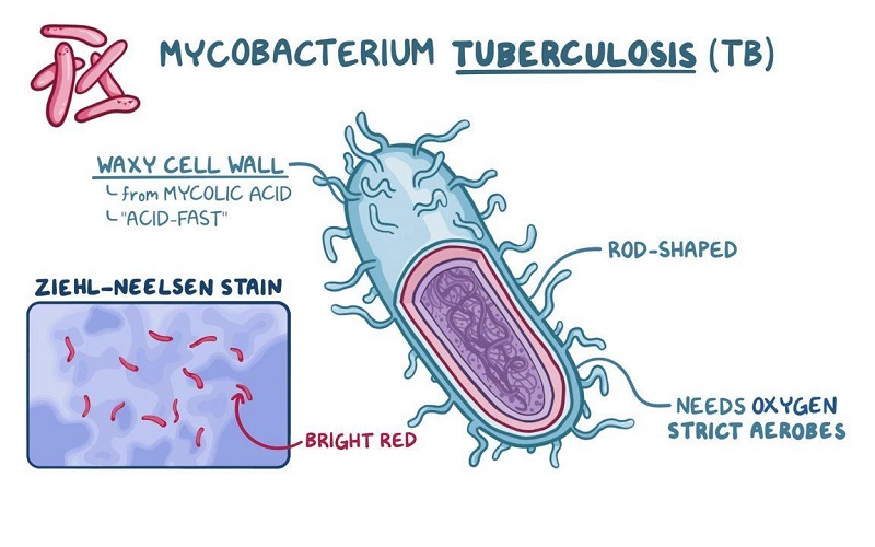 Mycobacterium tuberculosis gây bệnh lao xương khớp